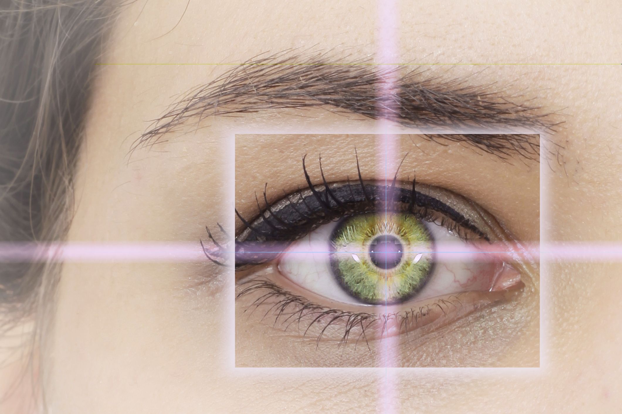 You are currently viewing Top 5 Reasons To Choose LASIK For Your Vision Correction
