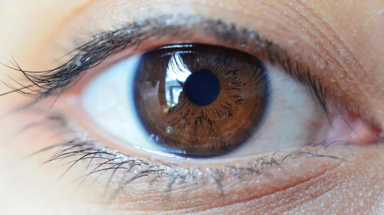 AlloFlo Uveo Device: Targeting Uveoscleral Outflow in Glaucoma